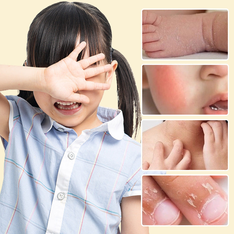 Baby Protective Balm for Cracked and Chapped Skin