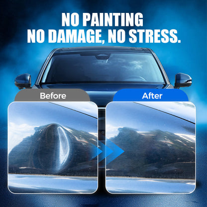🔥Hot Sale🚘Dent Repair Magic - Auto Body Dent Repair Suction Cup Tool