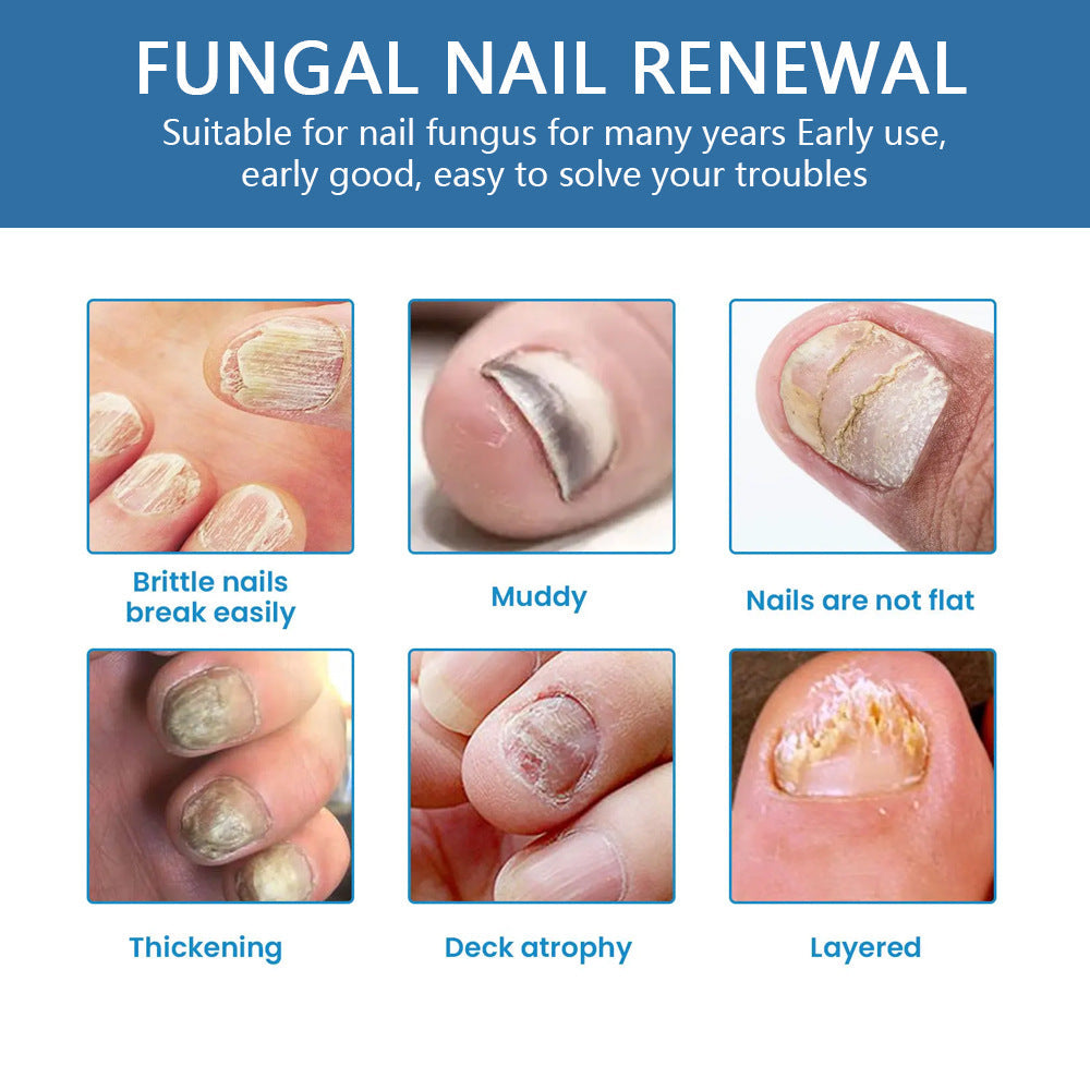 🔥Limited Time Promotion 50% OFF🔥Nail Fungus Treatment Solution