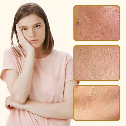 🎉2025 HOT SALE🎉 49% OFF🔥Organic Beef Tallow Balm with Honey – Moisturizing Cream