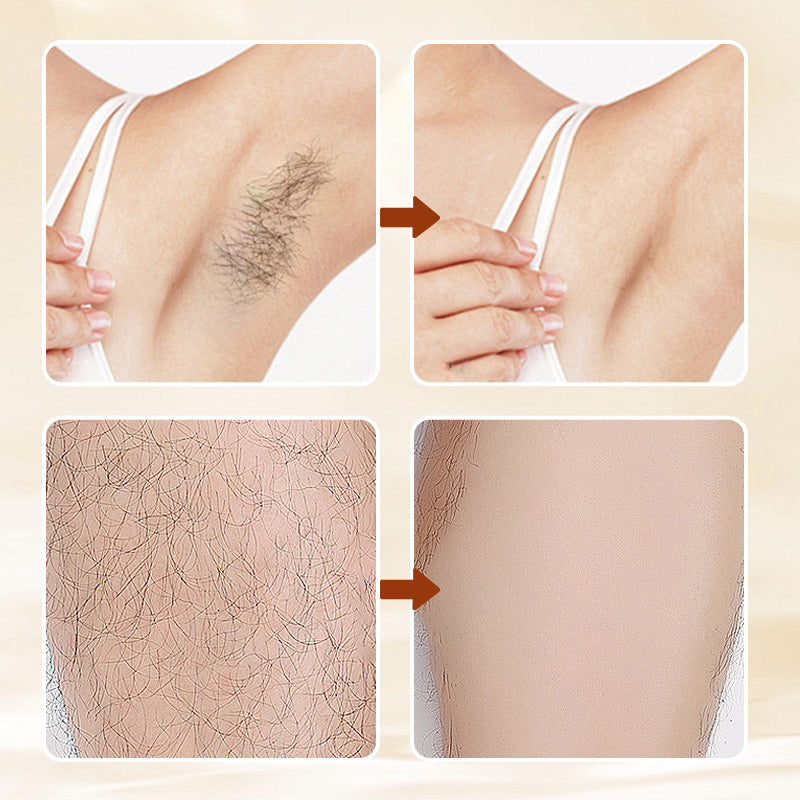 🔥HOT SALE 50% OFF🔥Versatile Aromatic  Hair Removal Cream 💥Buy 2 Free Shipping