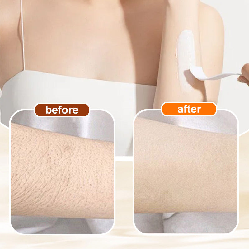 🔥HOT SALE 50% OFF🔥Versatile Aromatic  Hair Removal Cream 💥Buy 2 Free Shipping
