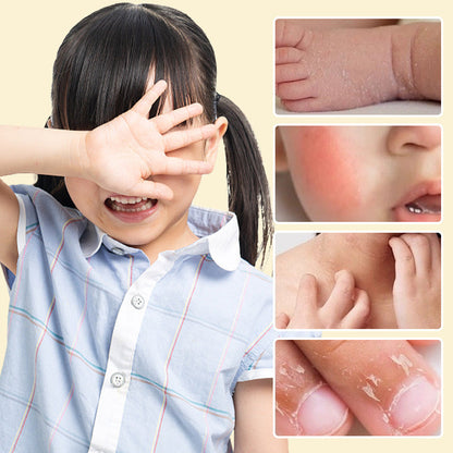 Baby Protective Balm for Cracked and Chapped Skin