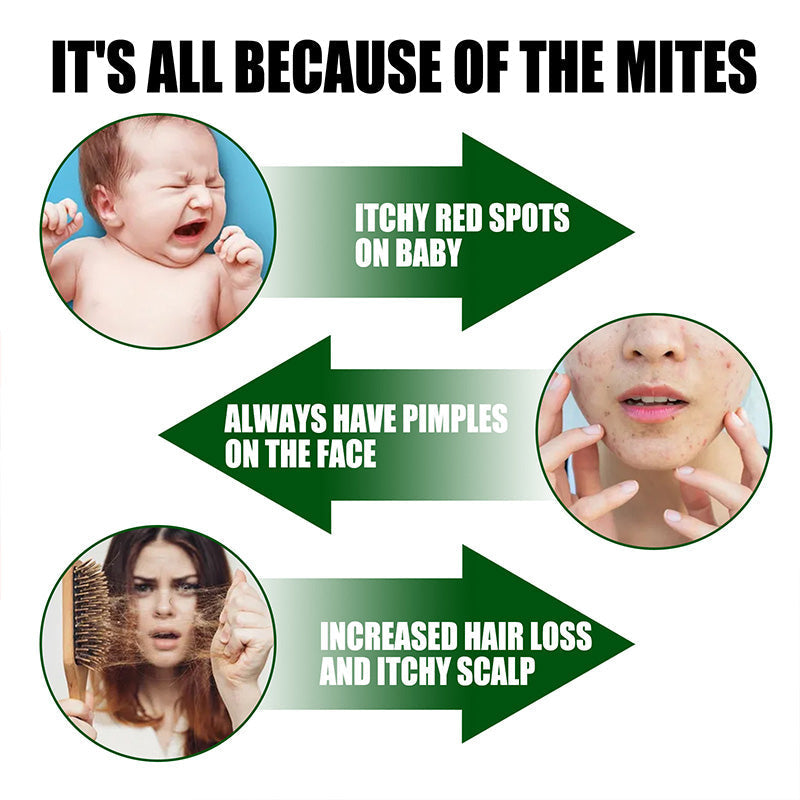 ⌛Limited Sale 50% OFF🔥Powerful Mite Remover Spray