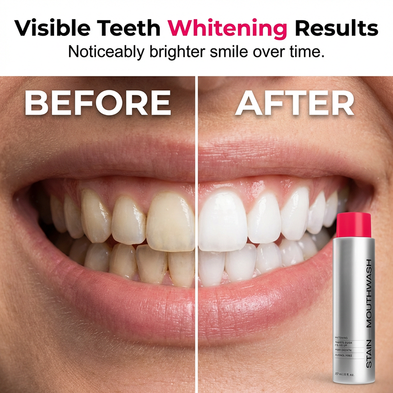🔥Limited Time Promotion 50% OFF🔥Advanced Stain-Removing Whitening Mouthwash