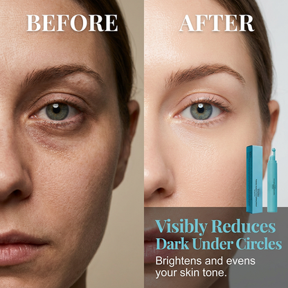 💝Peptide Eye Serum with Massage Applicator