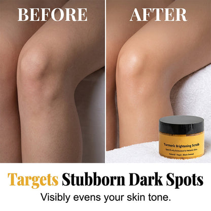 🏆 Last Day Special Price £8.99 ! 🔥BUY 2 GET 1 FREE🔥Turmeric Exfoliating Body Scrub